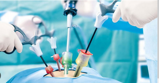 Laparoscopic Urology